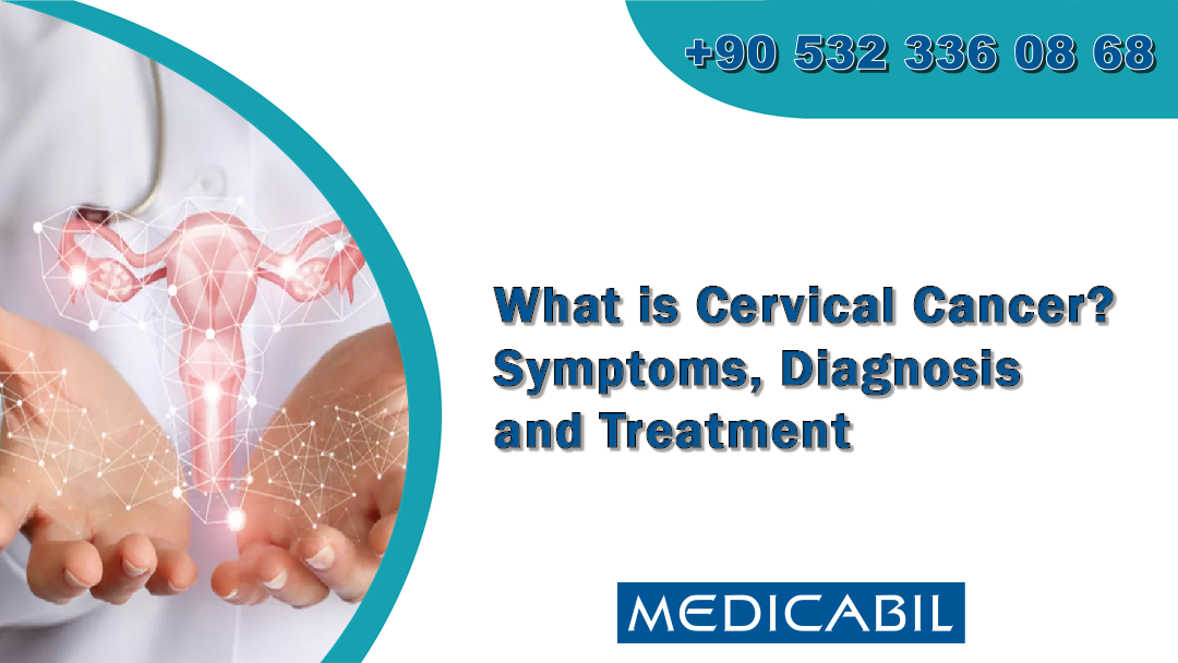 What is Cervical Cancer? Symptoms, Diagnosis and Treatment