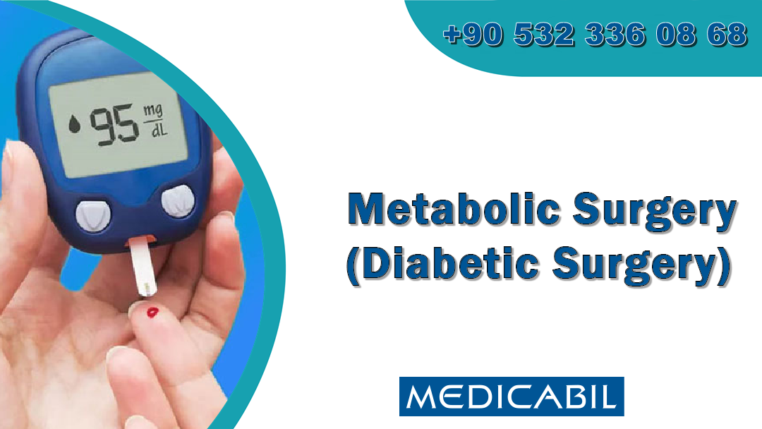 Metabolic Surgery (Diabetic Surgery)
