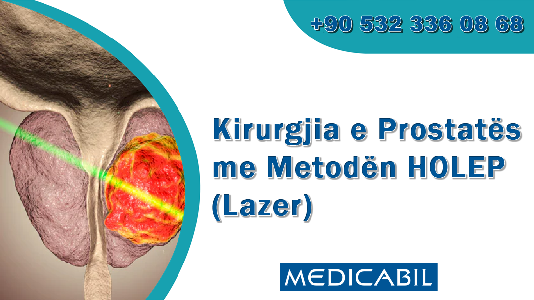 Kirurgjia e Prostatës me Metodën HOLEP (Lazer)
