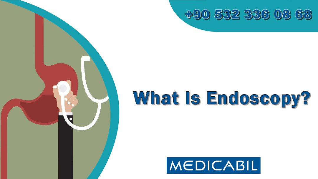 What Is Endoscopy?