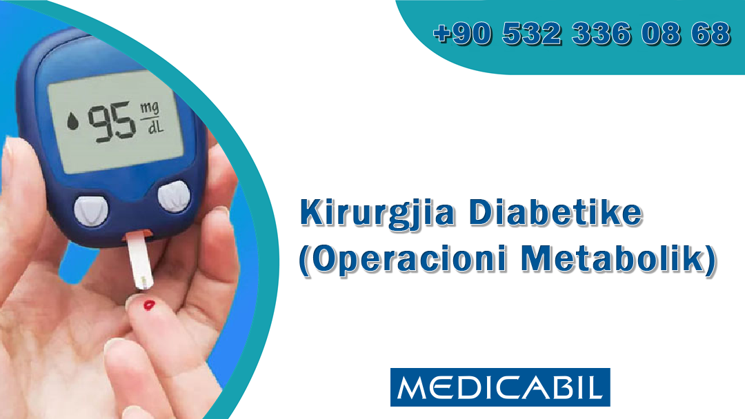 Kirurgjia Diabetike (Operacioni Metabolik)