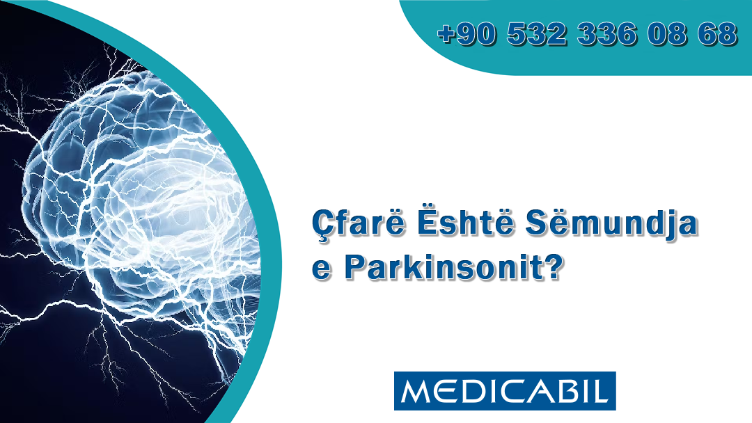 Çfarë Është Sëmundja e Parkinsonit?