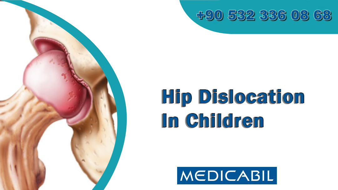 Hip Dislocation In Children