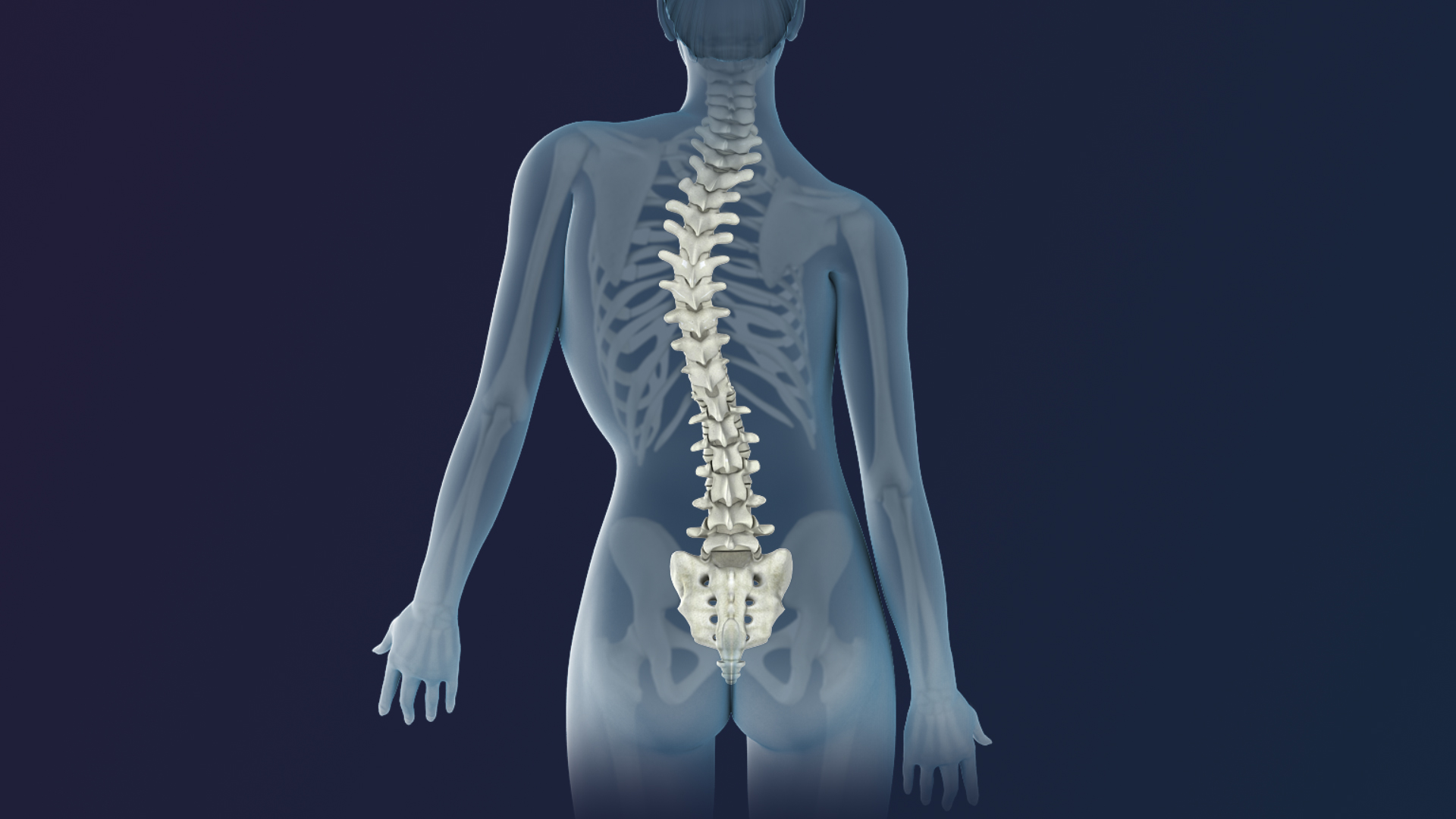 Scoliosis and Kyphosis