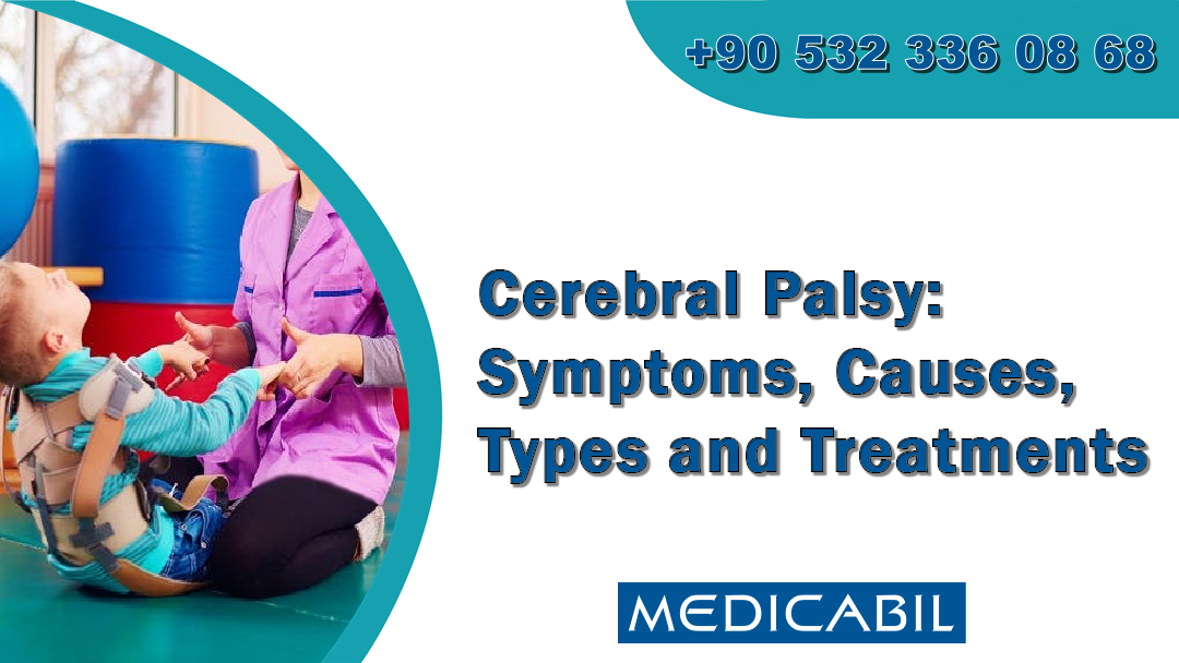 Cerebral Palsy: Symptoms, Causes, Types and Treatments