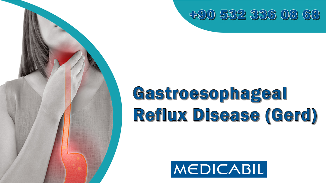 Gastroesophageal Reflux Disease (Gerd)