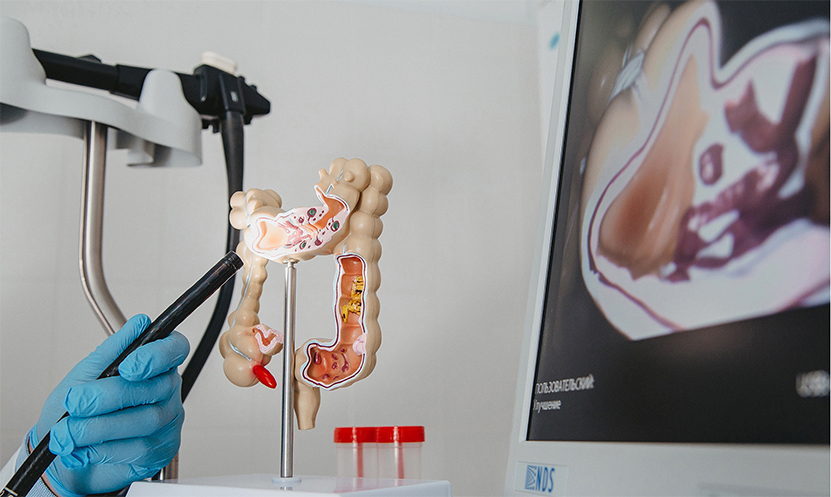 Насколько безопасна колоноскопия