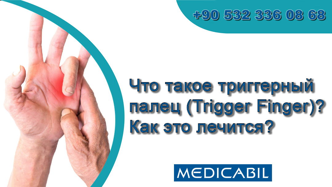 Что такое триггерный палец (Trigger Finger)? Как это лечится?