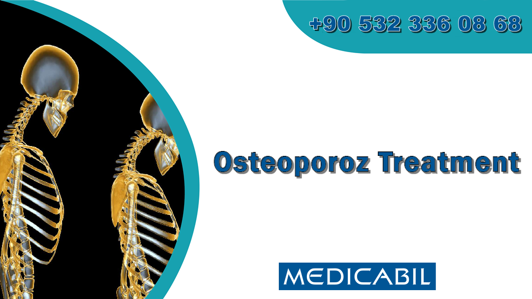 Osteoporoz Treatment