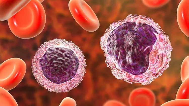 Çfarë Janë Monocitet? Cilat Janë Funksionet e Tyre? Çfarë Do Të Thotë Niveli i Ulët dhe i Lartë?