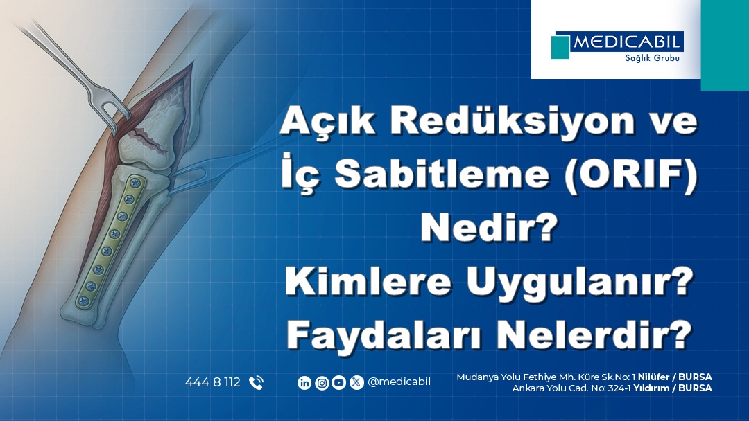 Açık Redüksiyon ve İç Sabitleme (ORIF) Nedir? Kimlere Uygulanır? Faydaları Nelerdir?