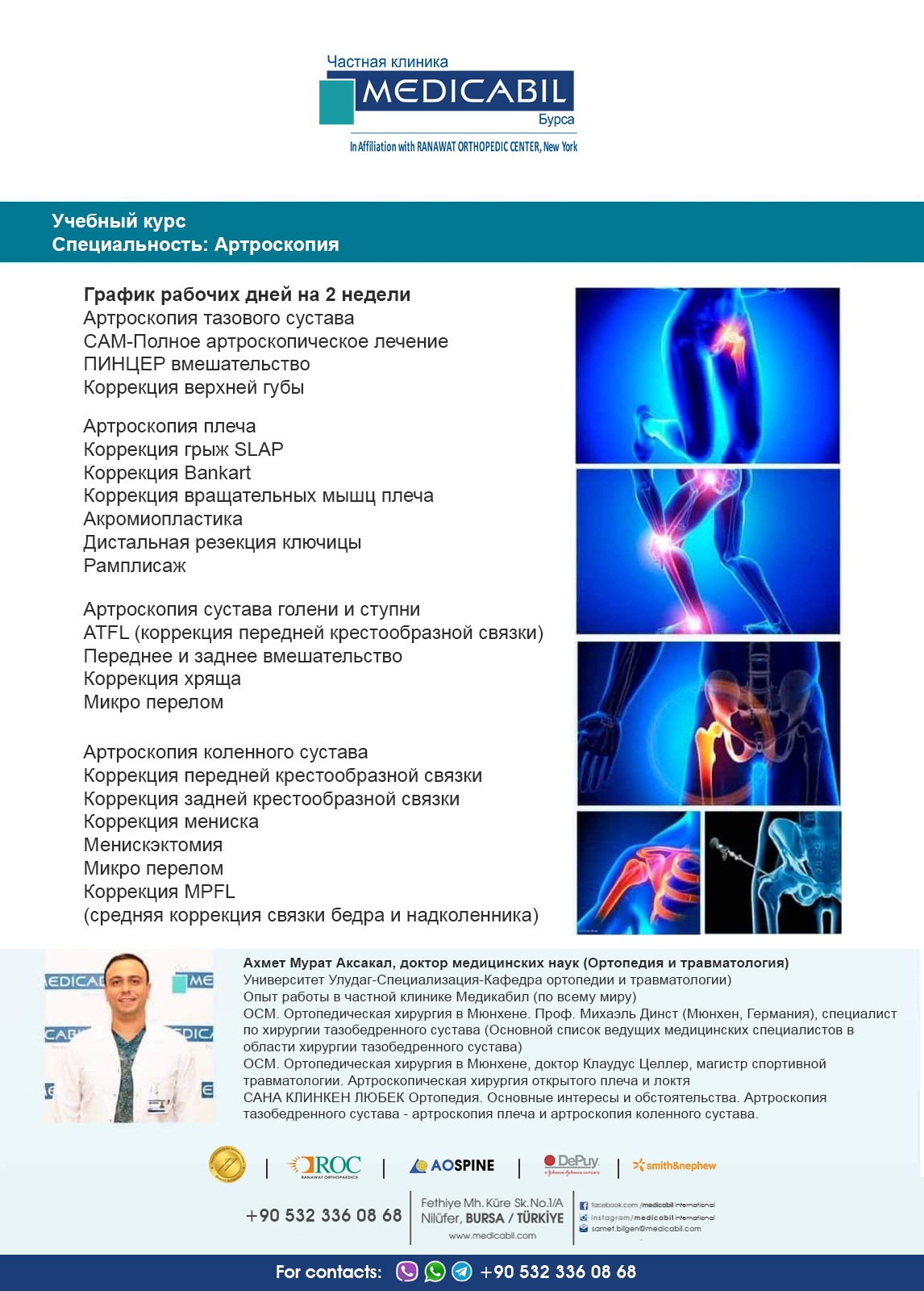 Артроскопия