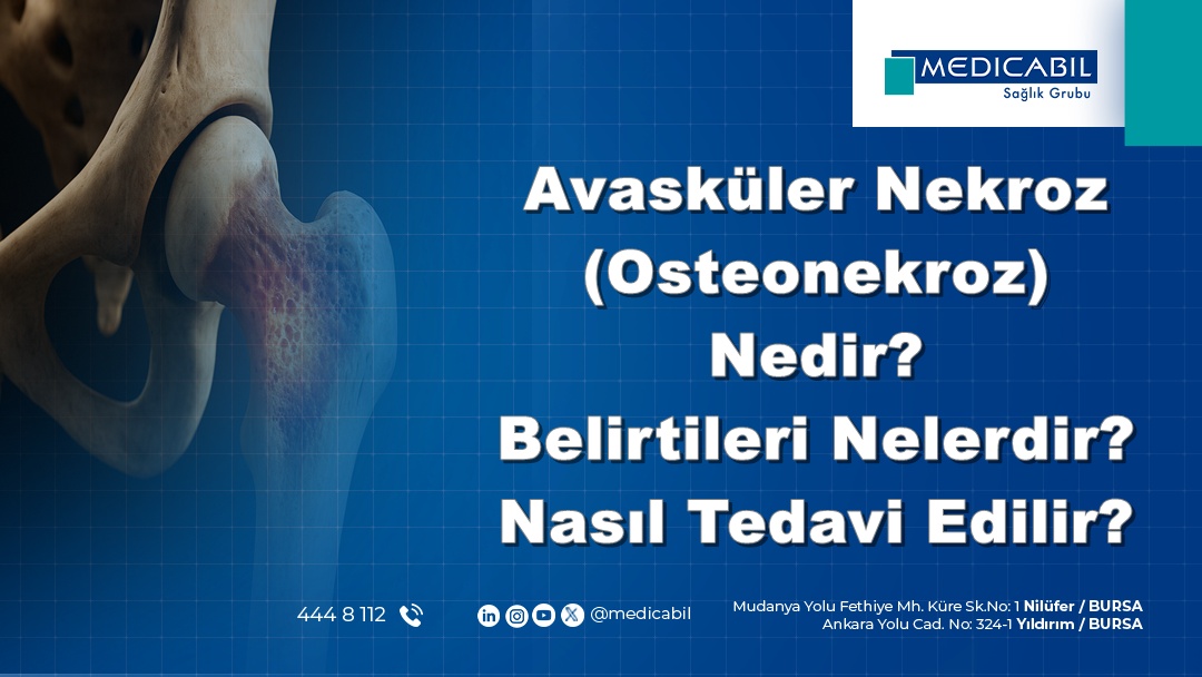 Avasküler Nekroz Nedir? Belirtileri ve Tedavisi