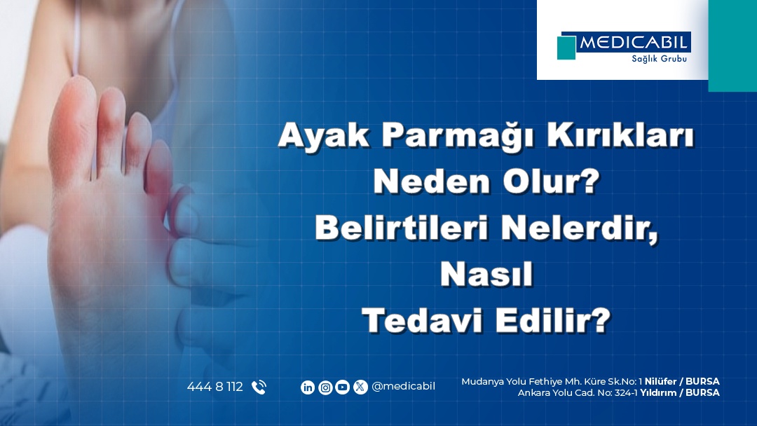 Ayak Parmağı Kırıkları Neden Olur? Belirtileri Nelerdir? Nasıl Tedavi Edilir?