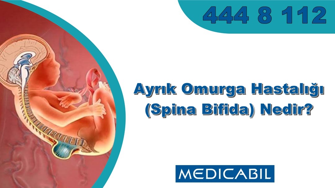Ayrık Omurga Hastalığı (Spina Bifida) Nedir?