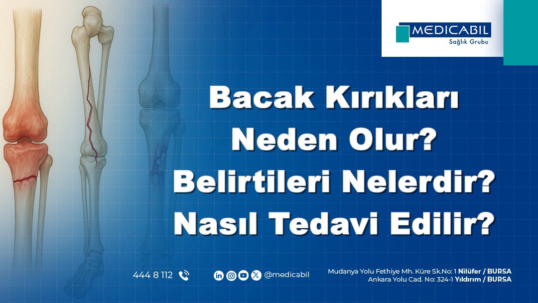 Bacak Kırıkları Neden Olur? Belirtileri Nelerdir? Nasıl Tedavi Edilir?