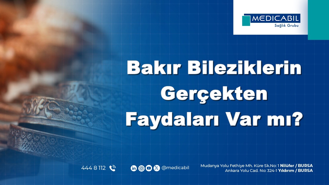 Bakır Bileziklerin Gerçekten Faydaları Var mı?