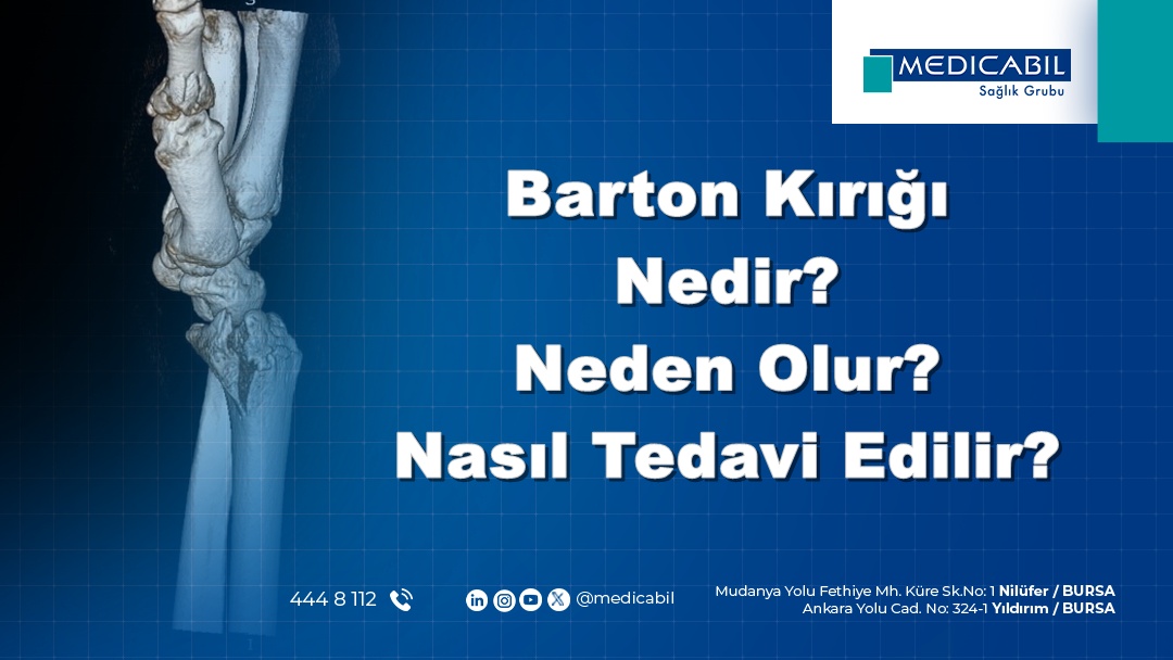 Barton Kırığı Nedir? Neden Olur? Nasıl Tedavi Edilir?