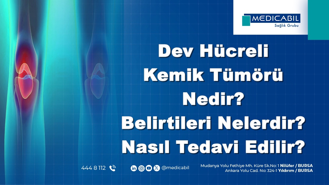 Dev Hücreli Kemik Tümörü Nedir? Belirtileri Nelerdir? Nasıl Tedavi Edilir?