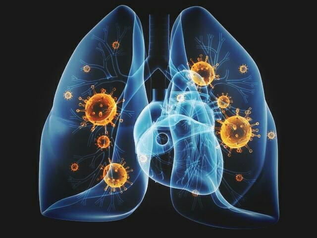 Si Trajtohet Pneumonia?