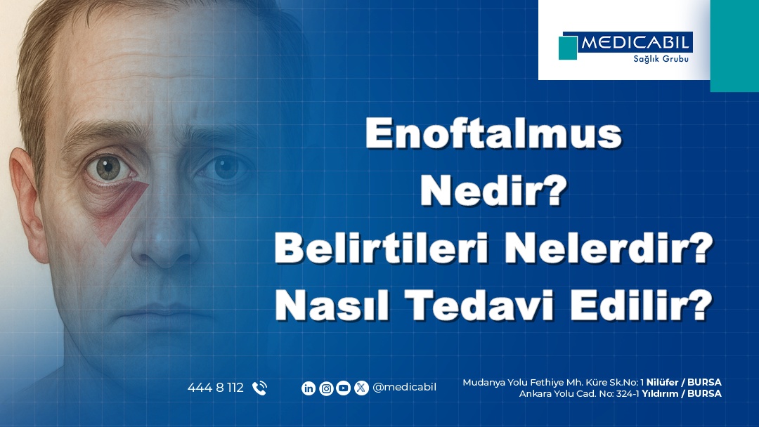 Enoftalmus Nedir? Belirtileri Nelerdir? Nasıl Tedavi Edilir?
