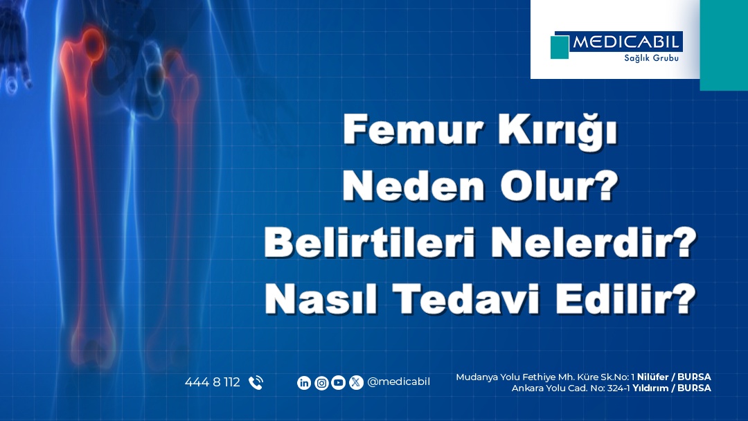Femur Kırığı Neden Olur? Belirtileri Nelerdir? Nasıl Tedavi Edilir?