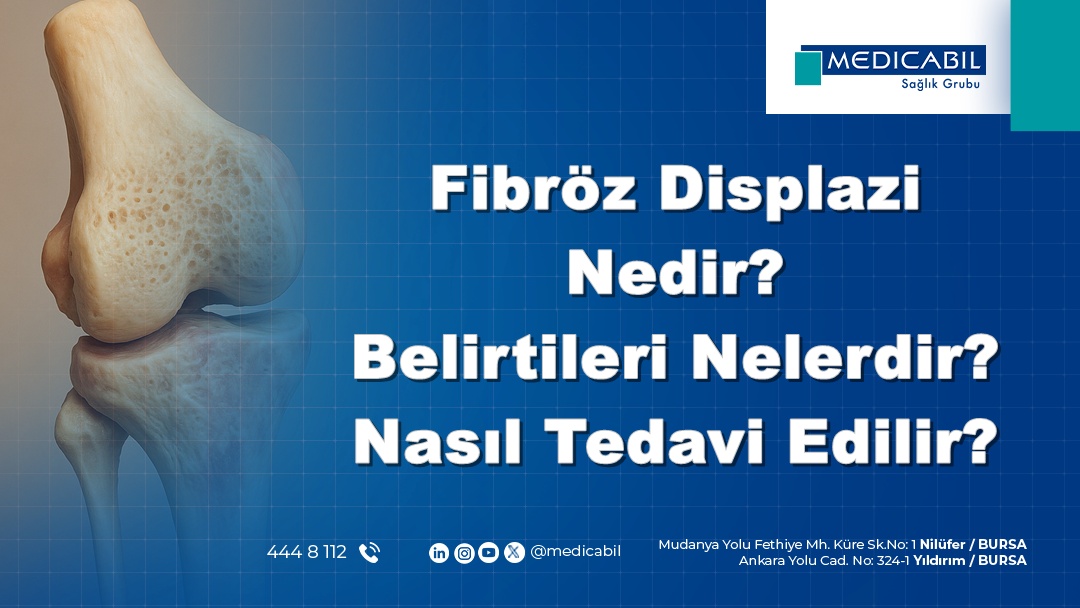 Fibröz Displazi Nedir? Belirtileri Nelerdir? Nasıl Tedavi Edilir?