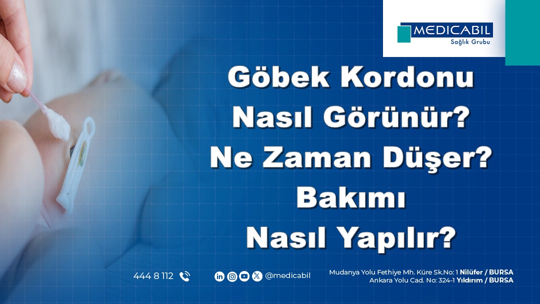 Göbek Kordonu Nasıl Görünür? Ne Zaman Düşer? Bakımı Nasıl Yapılır?
