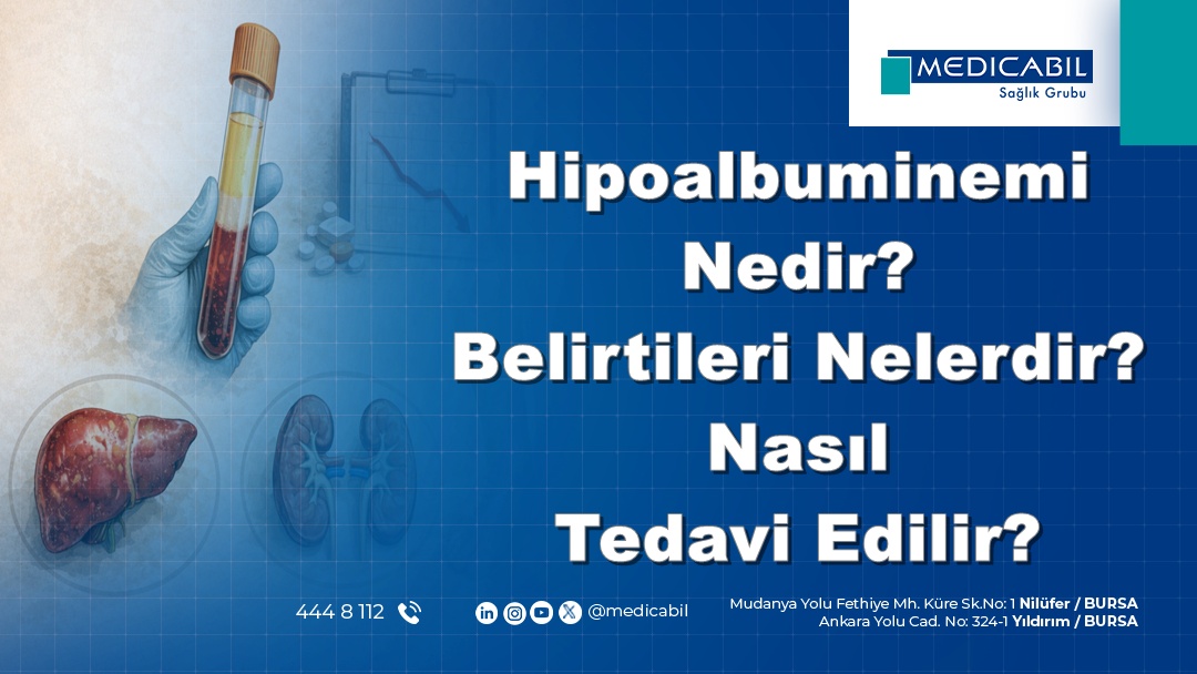 Hipoalbuminemi Nedir? Belirtileri Nelerdir? Nasıl Tedavi Edilir?