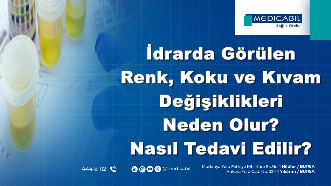 İdrarda Görülen Renk, Koku ve Kıvam Değişiklikleri Neden Olur? Nasıl Tedavi Edilir?