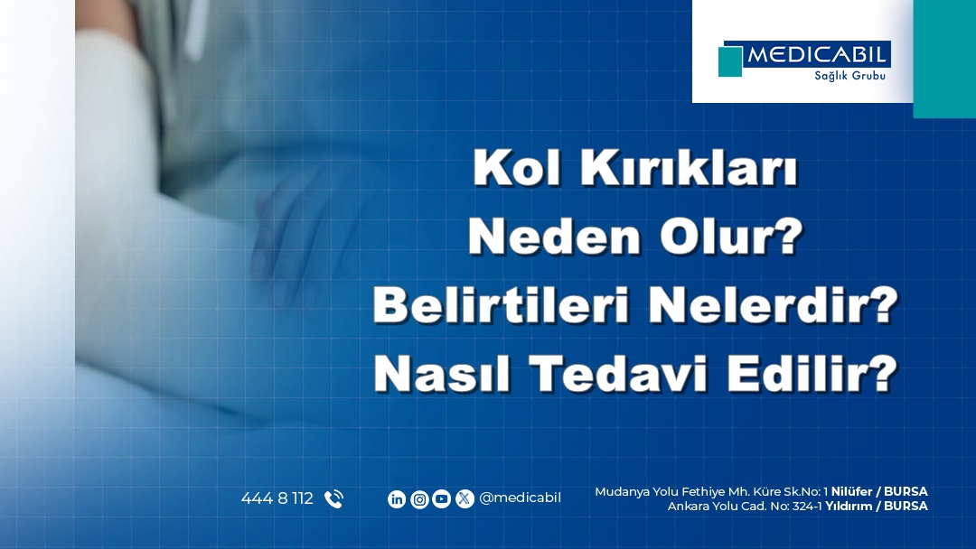 Kol Kırıkları Neden Olur? Belirtileri Nelerdir? Nasıl Tedavi Edilir?