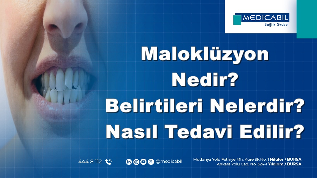 Maloklüzyon Nedir? Belirtileri Nelerdir? Nasıl Tedavi Edilir?