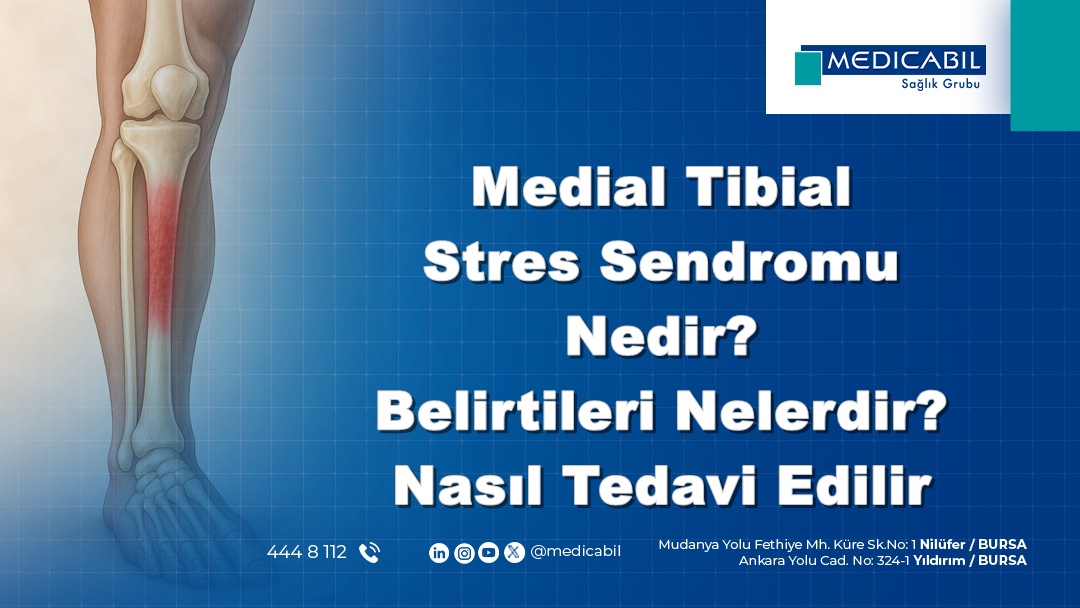 Medial Tibial Stres Sendromu Nedir? Belirtileri Nelerdir? Nasıl Tedavi Edilir?