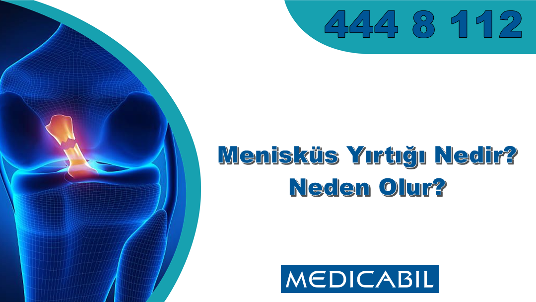 Blog | Menisküs Yırtığı Nedir? Neden Olur?