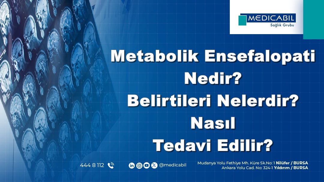 Metabolik Ensefalopati Nedir? Belirtileri Nelerdir? Nasıl Tedavi Edilir?
