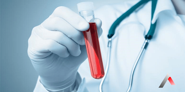 Çfarë është Një Test Gjaku MPV? Çfarë Do Të Thotë MPV e Ulët Ose e Lartë? Cilat Janë Simptomat?