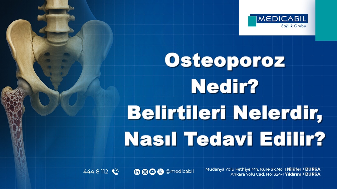 Osteoporoz Nedir? Belirtileri Nelerdir? Nasıl Tedavi Edilir?