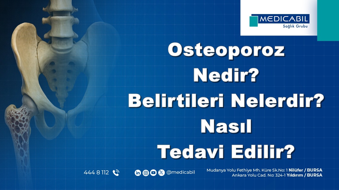 Osteoporoz Nedir? Belirtileri Nelerdir? Nasıl Tedavi Edilir?