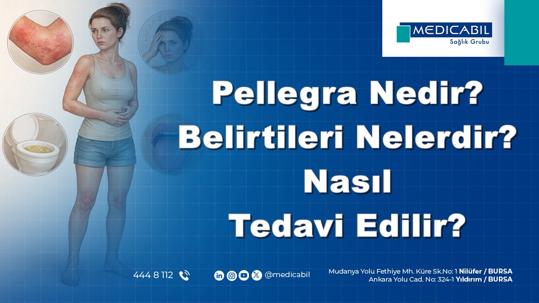 Pellegra Nedir? Belirtileri Nelerdir? Nasıl Tedavi Edilir?