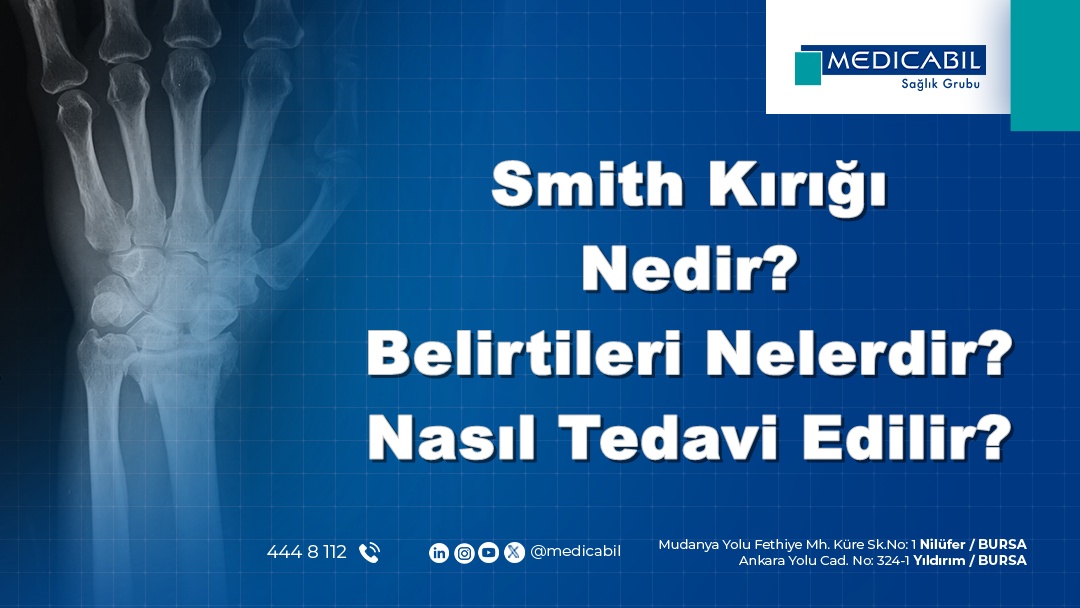 Smith Kırığı Nedir? Belirtileri Nelerdir? Nasıl Tedavi Edilir?