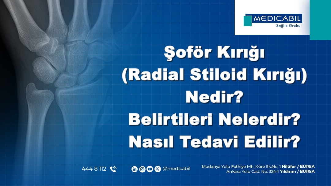 Şoför Kırığı (Radial Stiloid Kırığı) Nedir? Belirtileri Nelerdir? Nasıl Tedavi Edilir?