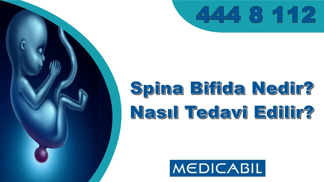 Spina Bifida Nedir? Nasıl Tedavi Edilir?