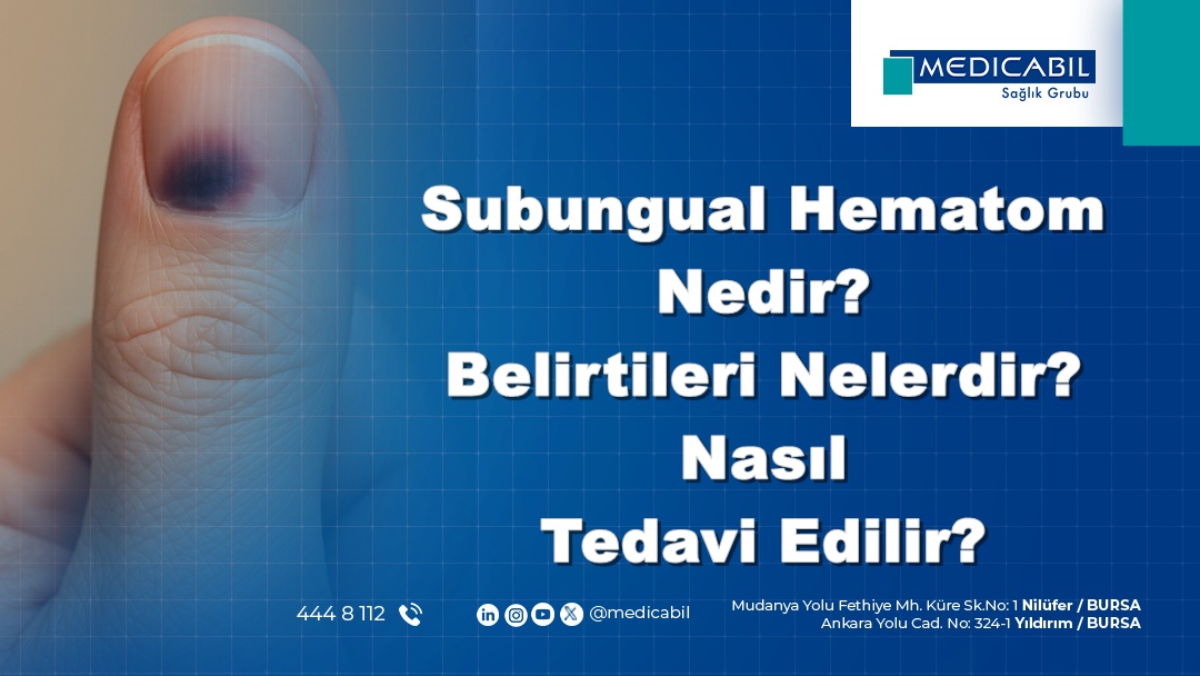 Subungual Hematom Nedir? Belirtileri Nelerdir? Nasıl Tedavi Edilir?