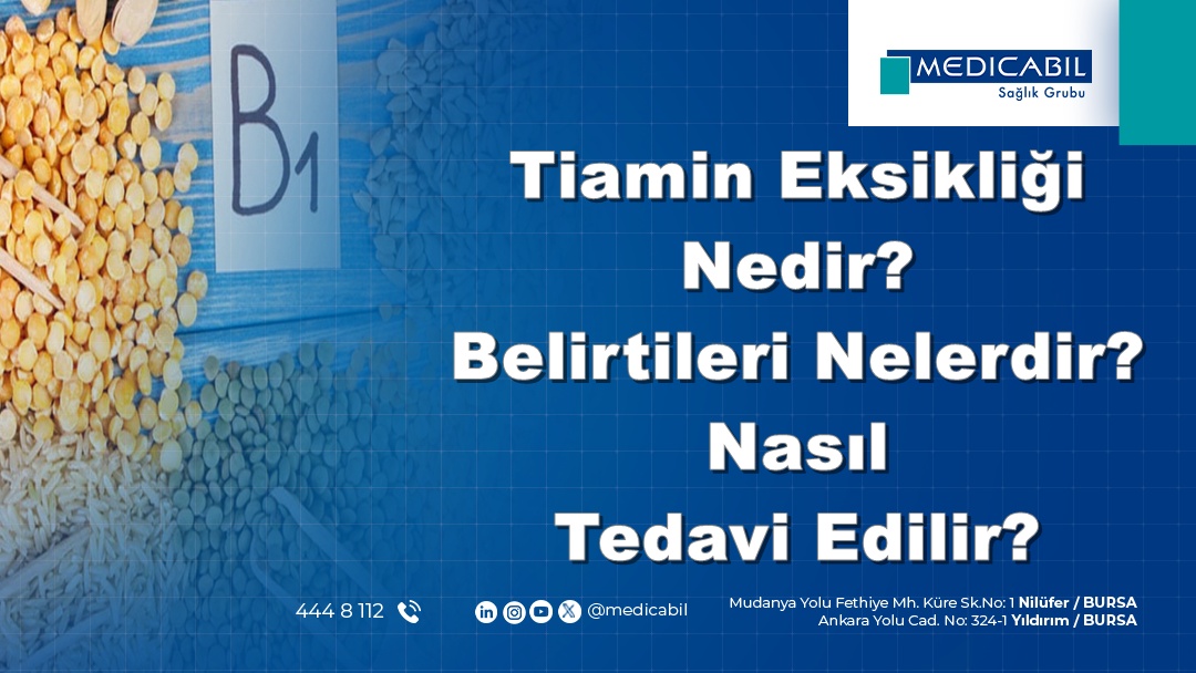 Tiamin Eksikliği Nedir? Belirtileri Nelerdir? Nasıl Tedavi Edilir?