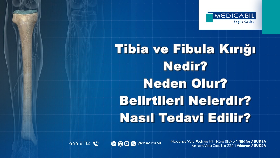 Tibia ve Fibula Kırığı Nedir? Neden Olur? Belirtileri Nelerdir? Nasıl Tedavi Edilir?