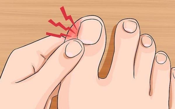 Si Të Parandaloni dhe Të Trajtoni Thonjtë e Këmbëve Të Rritur Nën Mish