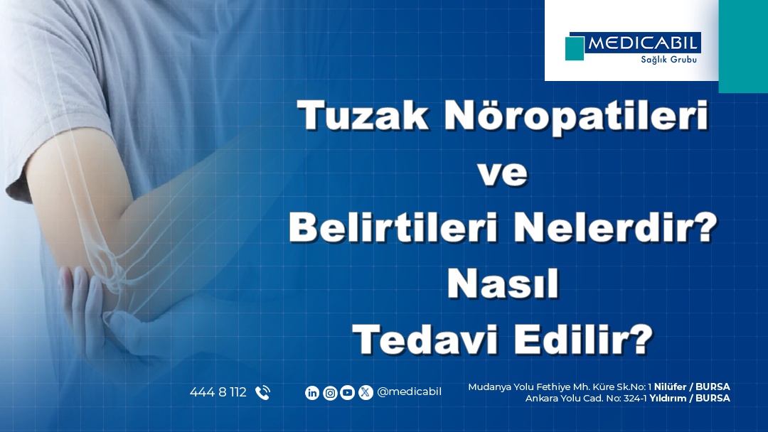 Tuzak Nöropatileri ve Belirtileri Nelerdir? Nasıl Tedavi Edilir?