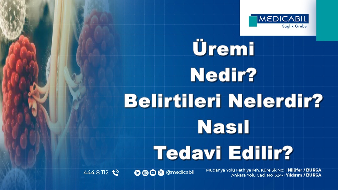 Üremi Nedir? Belirtileri Nelerdir? Nasıl Tedavi Edilir?