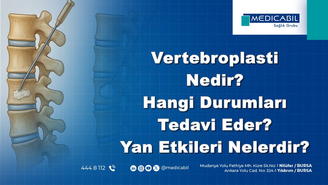 Vertebroplasti Nedir? Hangi Durumları Tedavi Eder? Yan Etkileri Nelerdir?