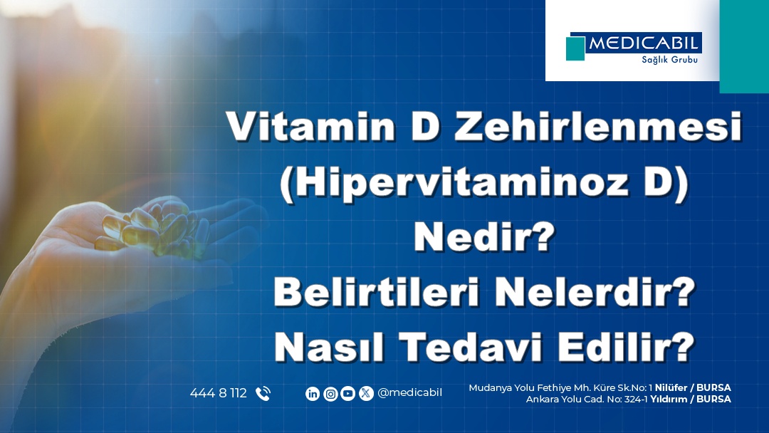 D Vitamini Zehirlenmesi (Hipervitaminoz D) Nedir? Belirtileri Nelerdir? Nasıl Tedavi Edilir?